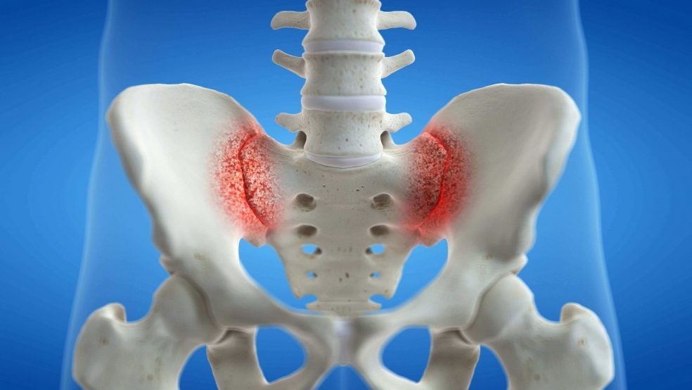 Sacroiliac Joint Block Pain Management Pain Solutions Medical